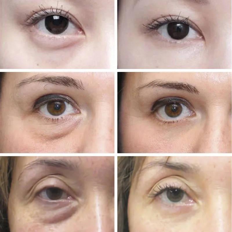 Anti Wrinkle Anti Dark Circle  - Skincare D'Alba recension och pris