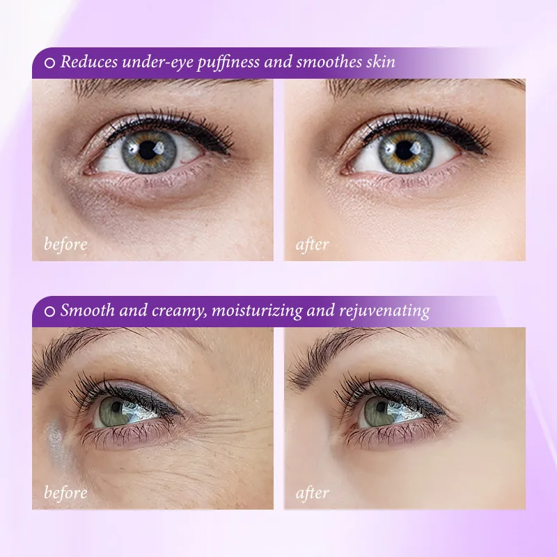 Instant Eye Bag Removal Cream  - Skincare D'Alba recension och pris